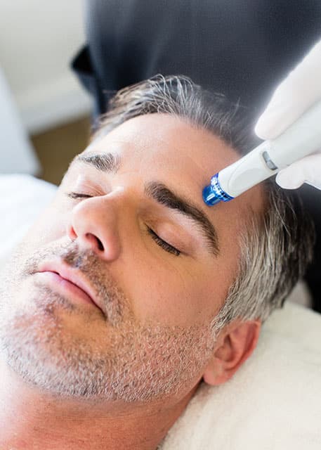 male patient receiving hydrafacial treatment