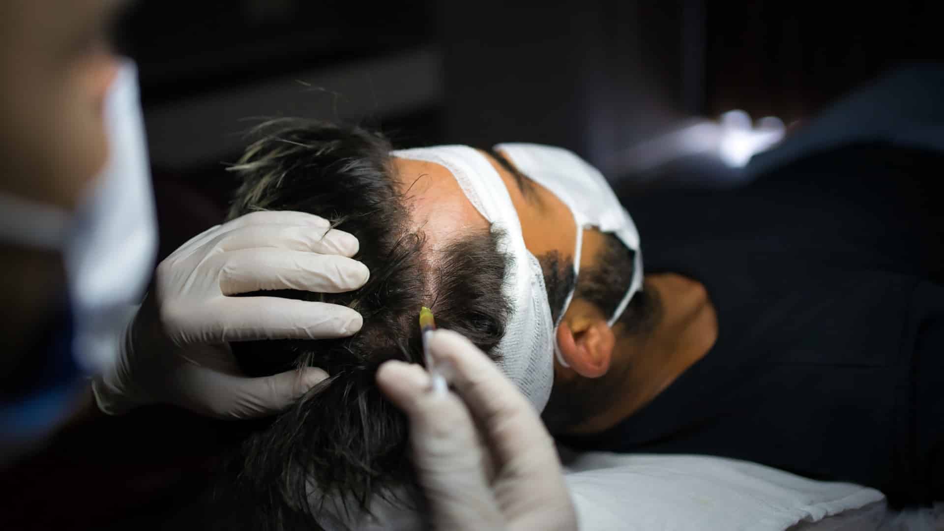 man with hair loss problem receiving injection in head.