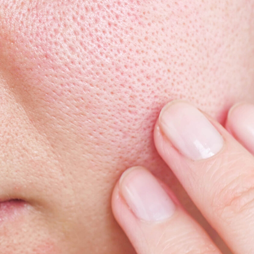pores